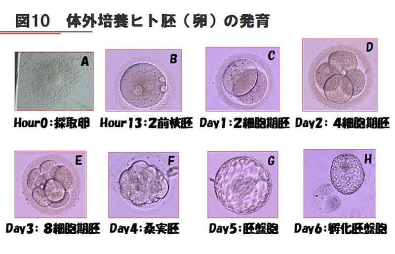 体外培養ヒト胚（卵）の発育を示す写真